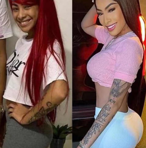Yailin la Más Viral antes y después de operarse: FOTOS de cómo lucía la