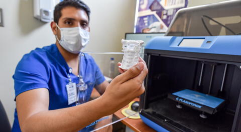 INSN San Borja utiliza impresión 3D para cirugías complejas en niños
