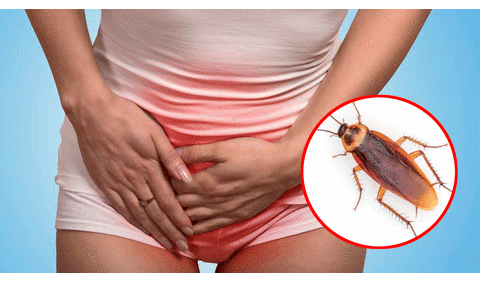 Encuentran una cucaracha en la vagina de una mujer que se sentía “extremadamente extraña"