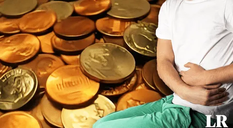 Hombre se salva de morir tras ingerir 39 monedas y 37 imanes: decía que "el zinc ayuda en el culturismo"