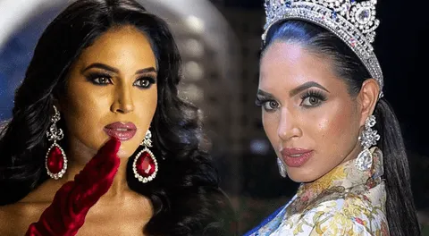 Wilevis Brito, excandidata a Miss Venezuela, falleció a los 24 años tras complicaciones en cirugía