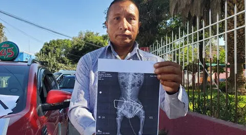 Arequipa: dueño de perro denuncia que veterinaria implantó perno de construcción en columna de mascota