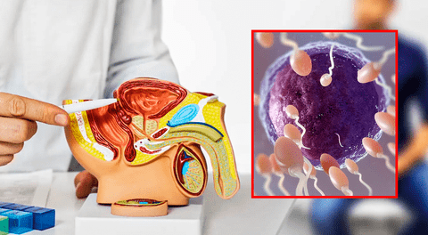 Eyacular al menos 21 veces al mes reduce el riesgo de padecer cáncer de próstata, según estudio de Harvard