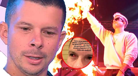 Mario Hart ALARMA al revelar que sufrió una FUERTE LESIÓN en el ojo: "Me clavé uno"