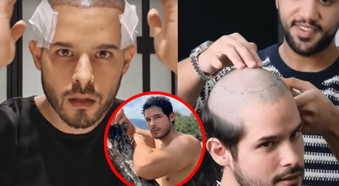 Andrés Vílchez se RAPA el pelo para una cirugía y deja a usuarios en SHOCK: "Ya no hay vuelta atrás"