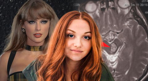 Fue al hospital por olvidar canción de Taylor Swift y descubre enfermedad cerebral que médicos ignoraron por un mes: "Dijeron que era normal"