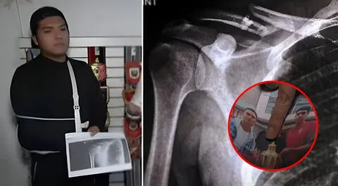 Golpean brutalmente a campeón de marinera en partido de fútbol tras pedir que "jueguen tranquilos", en Callao