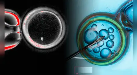 Científicos dan un paso clave frente a la infertilidad con óvulos humanos creados a partir de células de la piel