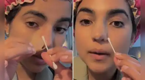 Susana Alvarado de Corazón Serrano muestra cómo luce su renovada nariz y enseña paso a paso su cuidado postoperatorio: "Va excelente"