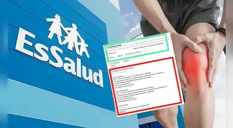 Fue por ecografía de rodilla y recibe una de mama: EsSalud lo llama “caso aislado”, pese a reincidencia en policlínico de Chorrillos