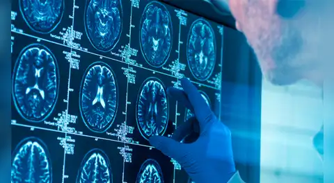 No es en la adolescencia: científicos revelan la edad en que el cerebro llega a la madurez y cuándo empieza a envejecer