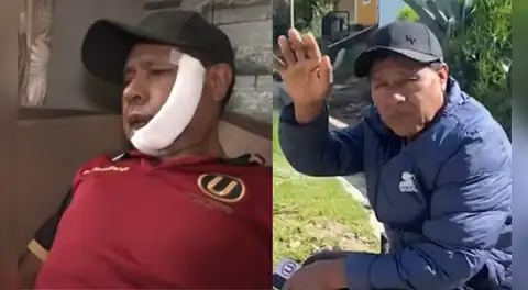 Adulto mayor sufre corte en su rostro al defender a su hija de sujetos en Villa El Salvador: recibió 26 puntos de sutura