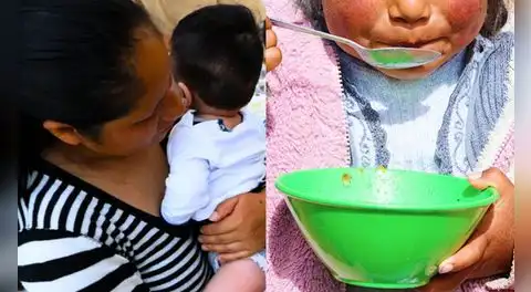 Anemia en el Perú: la emergencia silenciosa reflejo de la pobreza y el abandono estatal