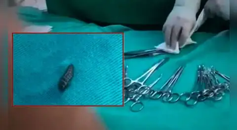 Larvas de mosca caen del techo durante cirugías en el Hospital Materno Infantil de Huancayo y desatan alarma sanitaria