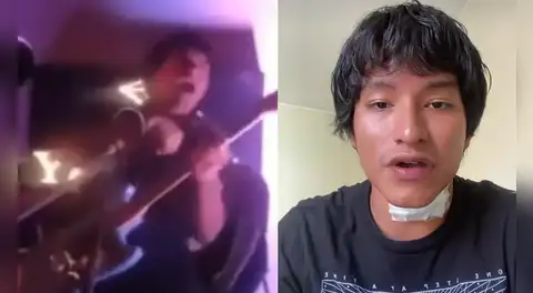 Cantante peruano sufre descarga eléctrica durante concierto en Centro de Lima y revela cómo sobrevivió al incidente: "Tengo quemaduras"