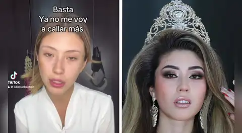 Lidia Barbachan, Miss Arequipa 2025, denuncia agresión física y psicológica por parte de su expareja: "No es la primera vez"