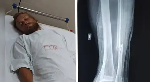 Turista ruso que recorría el mundo en bicicleta fue atropellado en Áncash y sufre grave lesión