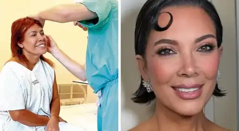 Magaly Medina confiesa que se hizo la misma cirugía que Kris Jenner, mamá de las Kardashian: “El presupuesto está por las nubes”