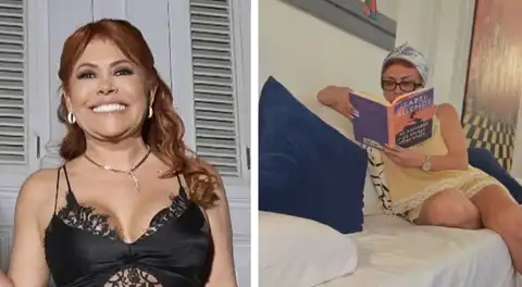 Magaly Medina comparte sin filtros su proceso de recuperación tras cirugía facial: “Mostrándoles orgullosamente mis moretones”