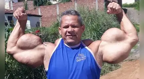 Fallece a los 55 años el ‘Popeye brasileño’, que se hizo famoso por someterse a tratamientos con aceite en los brazos para parecerse al personaje