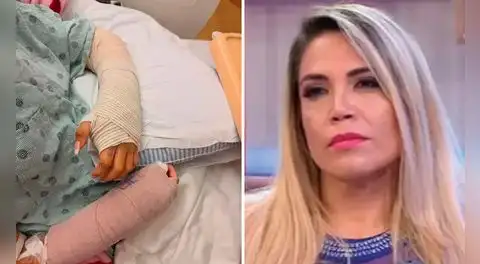 Anelhí Arias revela el difícil momento que vive por accidente de su hija con fuegos artificiales: "No es una fractura normal"