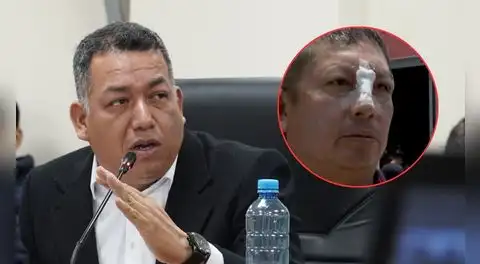 Darwin Espinoza habría agredido a señor en centro comercial: ciudadano manifiesta lesiones en la nariz