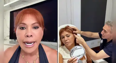 Magaly Medina sorprende al revelar que perdió sensibilidad en la oreja luego de operación estética en Argentina: "No siento mucho esa parte"
