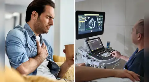 Crece el riesgo de infarto en peruanos menores de 50 años, alerta el Hospital Arzobispo Loayza