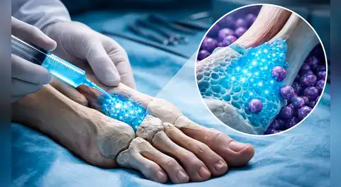 Científicos suizos crean un nuevo hidrogel que podría ser clave para reparar las graves fracturas óseas en corto tiempo