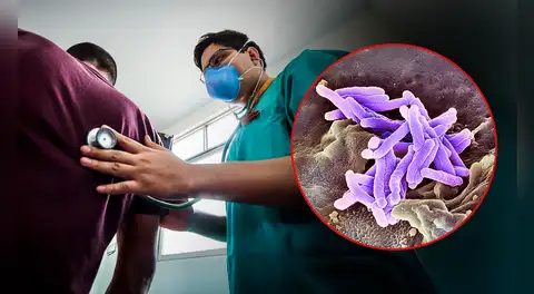 Falta de medicinas expone a pacientes con TBC resistente a graves secuelas