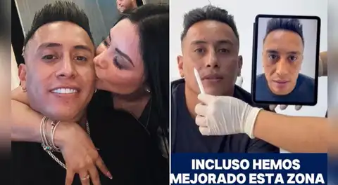Christian Cueva sorprende al someterse a tratamiento de masculinización y muestra resultados en su rostro