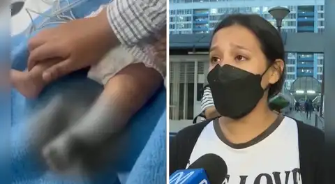 Madre denuncia que su bebé sufrió quemaduras en el Rebagliati y pide ayuda legal: “No tengo apoyo del hospital"