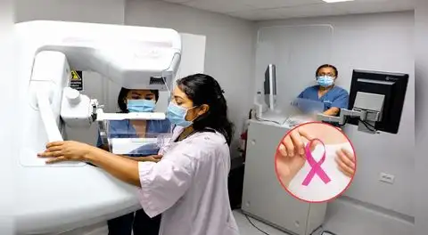 ¿Necesitas una mamografía? Hospital Santa Rosa ofrece este examen médico 100% gratuito sin seguro ni orden médica desde esta fecha