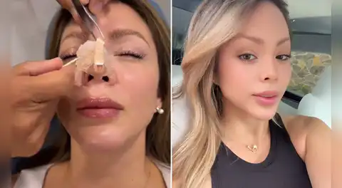 Sheyla Rojas muestra el resultado de su nueva rinoplastia tras retoque estético: "Quería que no me cambie la cara"