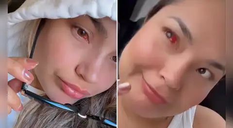 Lesly Águila aparece con aparente problema en los ojos: imágenes preocupan a los fans de Corazón Serrano