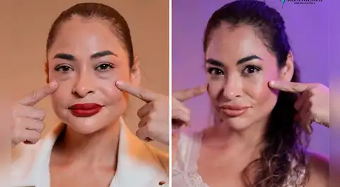 Melanie Martínez impacta al mostrar su nuevo rostro tras someterse a cirugía estética: “Gracias por devolverme la juventud”