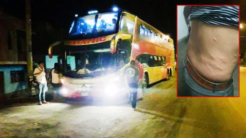 Pasajeros sufrieron picaduras de chinches durante viaje de Chiclayo a Lima