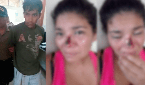 Desfigura el rostro a su expareja porque no quiso regresar con él en Nuevo Chimbote