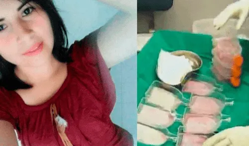 Eyvi Ágreda necesitará que su piel sana sea cultivada en el Instituto Nacional de Salud del Niño [VIDEO]