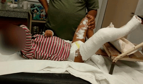 Una reja de más de 80 kg cae sobre un niño: “Bruno está vivo de milagro”