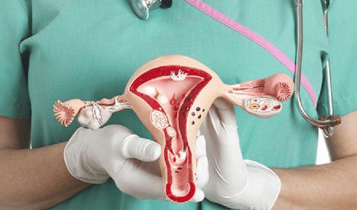 El cáncer de cuello uterino, en el 70% de casos, es ocasionado por el Virus del Papiloma Humano (VPH).