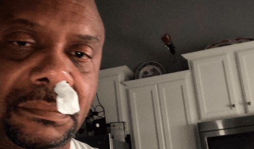 Creyó que tenía una alergia, pero revisión médica reveló amarga realidad