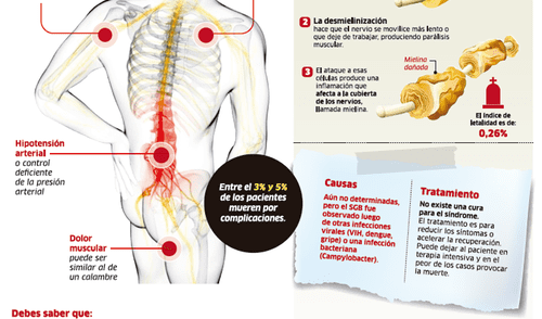 Guillian-Barré, un síndrome que paraliza el sistema nervioso
