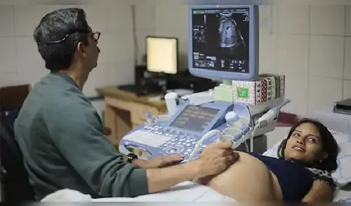 coronavirus y gestantes