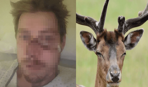 Cazador quedó con el rostro desfigurado. Foto: El Clarín