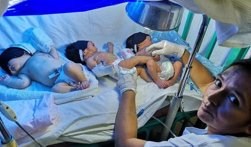 Viven. Los bebés prematuros son salvados al mantener su calor corporal en tinas convertidas en "incubadoras". Viven. Los bebés prematuros son salvados al mantener su calor corporal en tinas convertidas en "incubadoras."