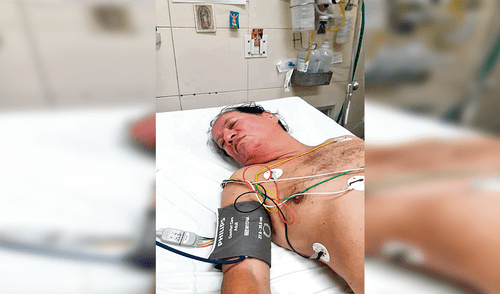 Hospitalizado. Hombre sufrió severa descompensación.