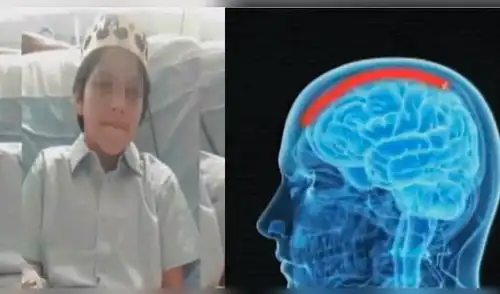 Piden ayuda para menor de 12 años que posee una extraña ameba en su cerebro [VIDEO]