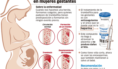 Tratamiento de las trombofilia en mujeres gestantes [INFOGRAFÍA]