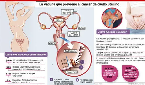 Vacunarán a escolares mujeres contra cáncer de cuello uterino [INFO]